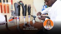 Impresas en 3D: fabrican prótesis para ayudar a personas sin extremidades