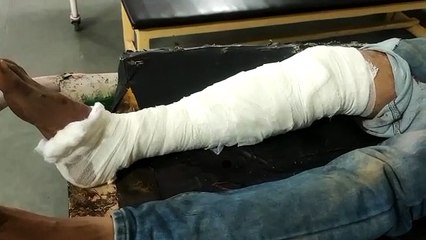 टैंट लगाकर लौट रहा था युवक, हो गया हादसा,देखे वीडियो