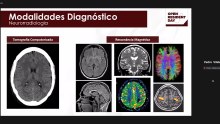 Neurorradiologia