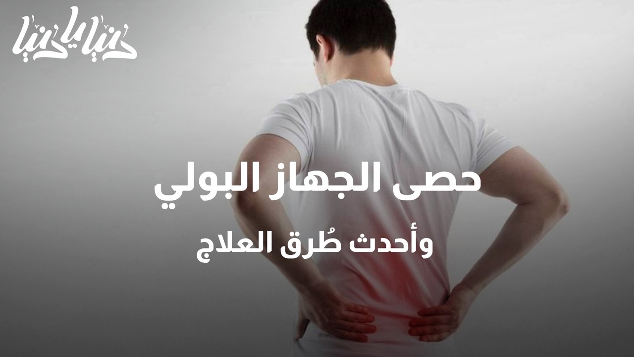 حصى الجهاز البولي وأحدث طُرق العلاج