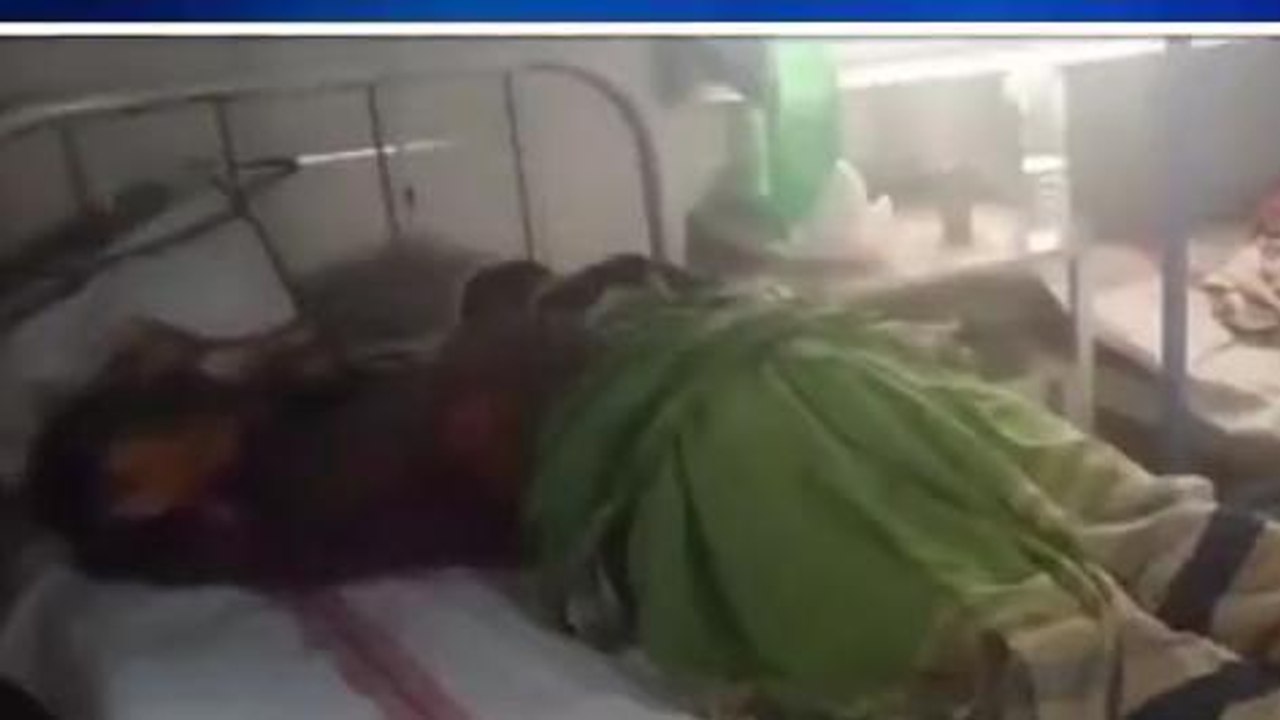 सीधी: पारिवारिक विवाद में जेठ ने महिला पर किया हमला, अस्पताल में जारी ईलाज