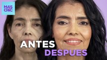 Lucir 10 años más joven: ANTES y DESPUÉS | Mas Chic