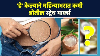 अंगावरील स्ट्रेच मार्क्स कसे घालवायचे? | How to Remove Stretch Marks Naturally at Home | AI2