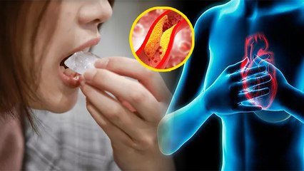 बार बार बर्फ खाने से Pagophagia Disorder, Reason Treatment जानना जरूरी | Boldsky