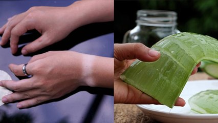 घड़ी पहनने से कलाई पर पड़े निशान कैसे हटाए | How to Remove Tanning On Wrist | Boldsky