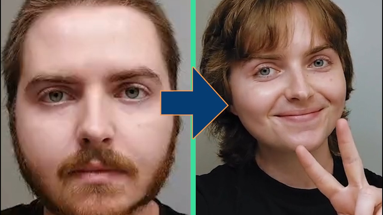 Trans woman documents physical changes by takin...