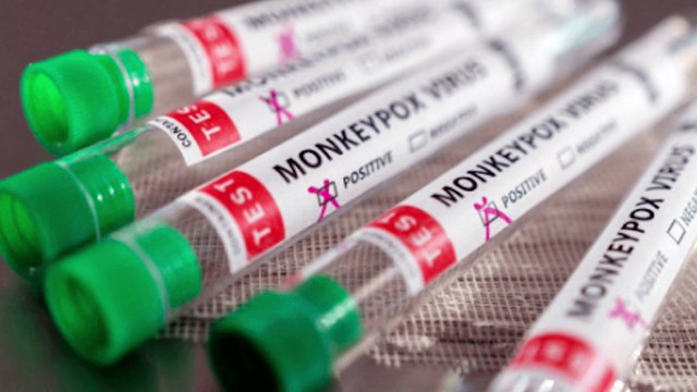 WHO declares mpox no longer a global health emergency