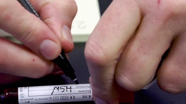 Exame de sangue pode ajudar a prevenir e entender abortos espontâneos