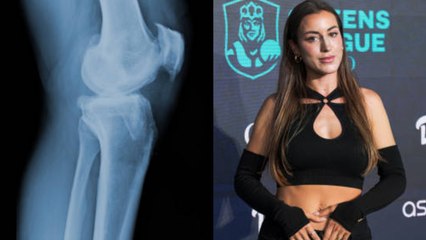 La Influencer Paula Gonu Se Ha Comido Su Propia Rodilla
