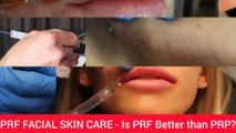 PRF SKIN TREATMENT - Is PRF Better than PRP?