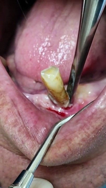 Dentist ASMR dental digest Doctor TEETH
