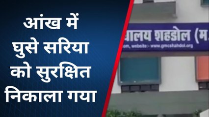 दर्दनाक: मासूम की आँख में घुसा सरिया,video देख उड़ जायेंगे होश