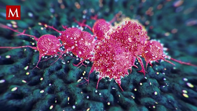 Joven sobrevive a cáncer 18 años pese a las bajas expectativas médicas