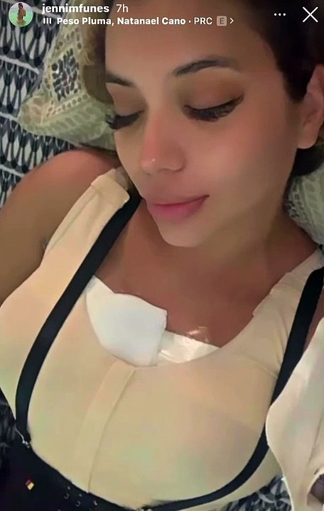 Jennifer Fúnes se somete a nueva cirugía estética