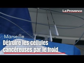 Download Video: Marseille : détruire les cellules cancéreuses par le froid