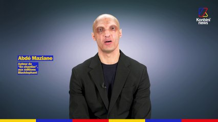 Acteur dans les caméras cachés de Greg Guillotin, Abdé Maziane est atteint de dysplasie ectodermique