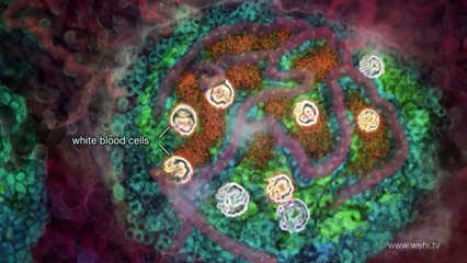 With 1 in 4 adults living with diabetes, Pakistan has highest