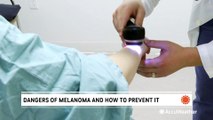 The dangers of melanoma