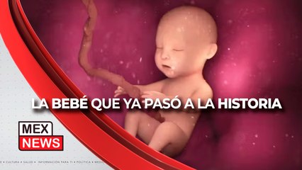 OPERAN a un BEBÉ dentro del ÚTERO para salvarlo