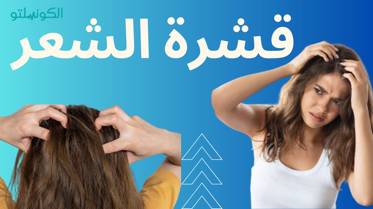 أسباب قشرة الشعر وكيفية التخلص منها ؟