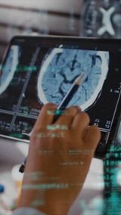 L'Institut Curie a mis au point une technologie révolutionnaire : une intelligence artificielle capable de détecter des cancers ! 