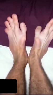 ¡No creerás lo que sucede con estos pies! La increíble mutación que debes ver
