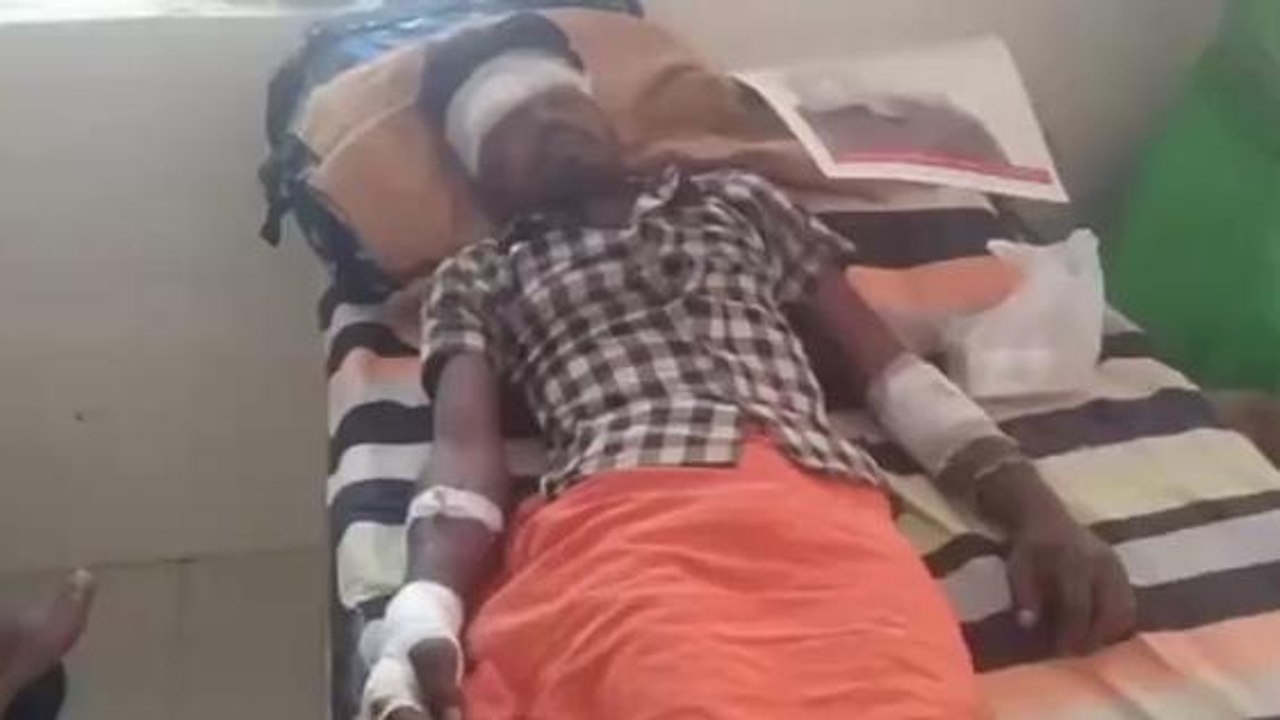 सीधी: स्पीड ब्रेकर के कारण बाइक चालक युवक हुआ दुर्घटना का हुआ शिकार