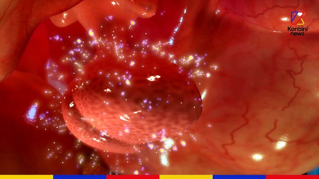 Les effets de la musique sur notre corps l Simple