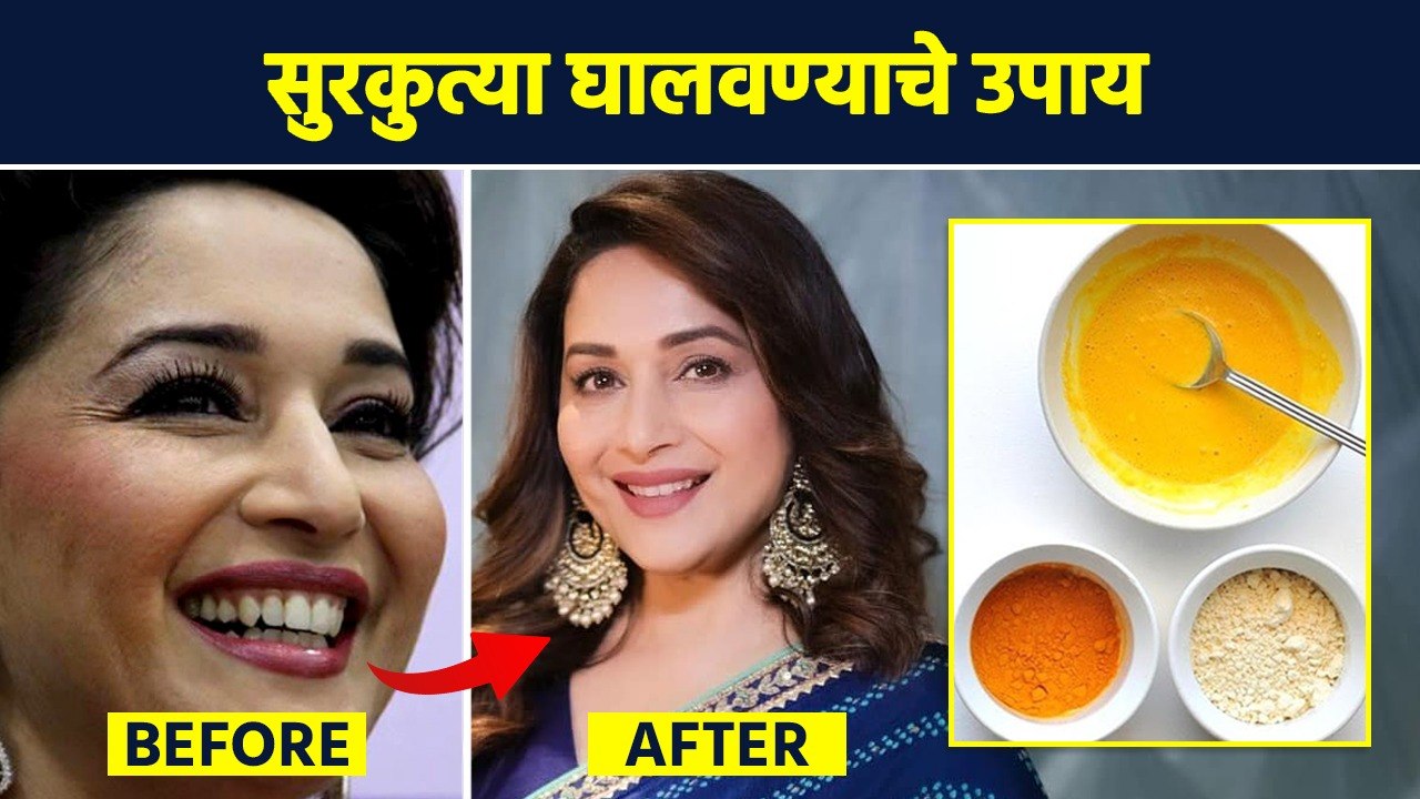 नैसर्गिक पद्धतीने सुरकुत्या कमी करू शकतो का? |...