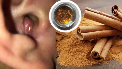 कान में फुंसी होने पर क्या करें | Kaan Ki Funsi Door Karne Ke Tarike | Boldsky