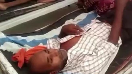 सीधी: जंगल में गए व्यक्ति पर जंगली सूअर ने किया प्राणघातक हमला