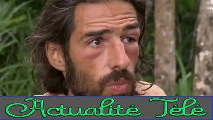 Esteban (Koh-Lanta) défiguré par son œil boursouflé, il dévoile ce qu’il a réellement.