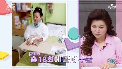 철심이 박혀있는 엄마의 목? 무려 18번의 수술! 고통받는 엄마의 사연