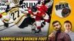 Why Was Hampus Lindholm Playing with a Broken Foot | Poke the Bear