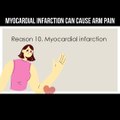 Myocardial infarction can cause arm pain