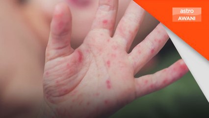 Bilangan kes melepasi paras amaran kebangsaan