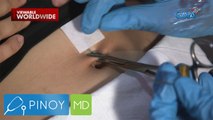 Babae, hinimatay habang nagpapa-body piercing | Pinoy MD