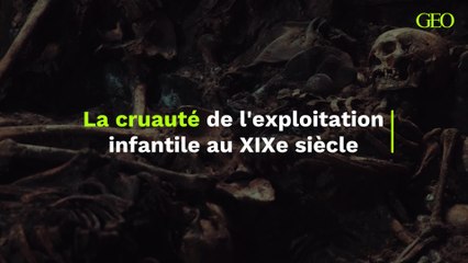 Choc et Révélation : L'Exploitation Infantile au XIXe Siècle à Travers des Squelettes Mutilés 🕯️
