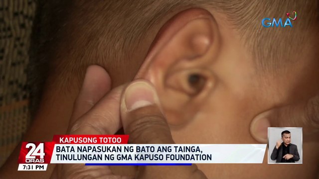 Bata napasukan ng bato ang tainga, tinulungan ng GMA Kapuso Foundation | 24 Oras