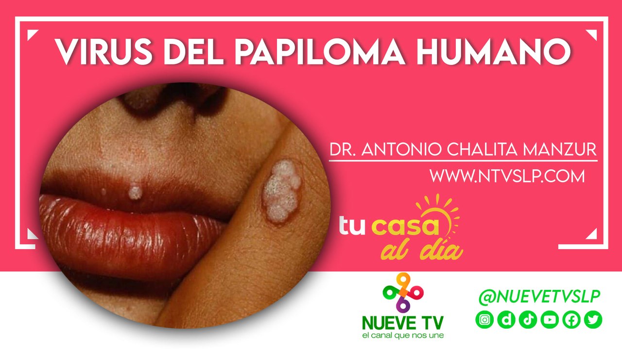 Virus del papiloma humano