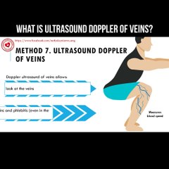 What is ultrasound Doppler of veins?