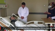 83 yaşındaki hastanın mesanesinden 250'den fazla taş çıkarıldı! Manzara ameliyatı yapan doktoru da şaşırttı