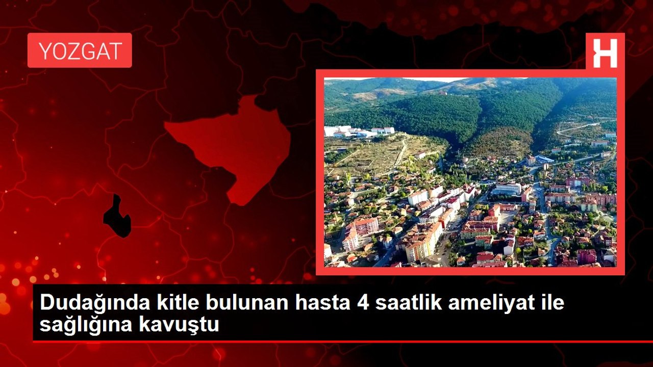 Dudağında kitle bulunan hasta 4 saatlik ameliyat ile sağlığına kavuştu