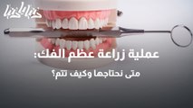 عملية زراعة عظم الفك متى نحتاجها وكيف تتم؟