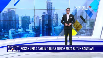Kisah Intan, Bocah 3 Tahun di Banten Derita Tumor di Mata Kiri