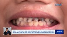 73-M Pinoy ang may sira ang ngipin; halos kalahati ng populasyon ang hindi nakakapagpatingin sa dentista — DOH | Saksi