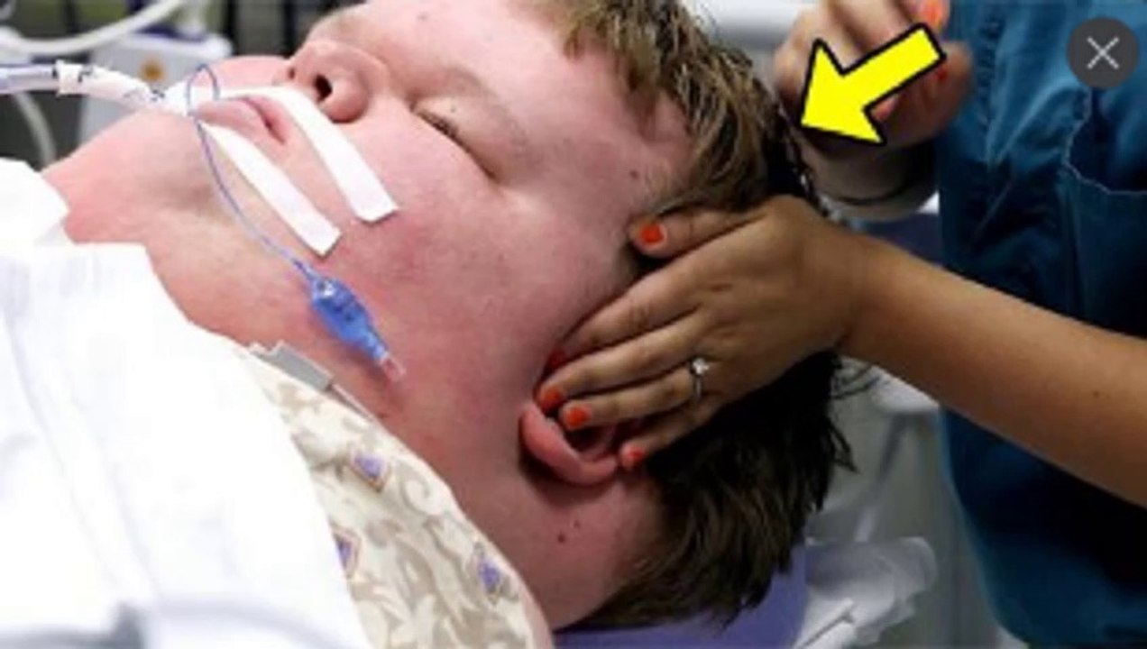 Pesaba 324 Kg Y No Paraba De Engordar. Entonces Sus Padres Hicieron Algo Arriesgado