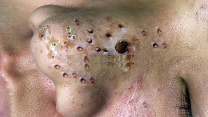 Traitement visage efficace avec Thuy SDS Skincare | 