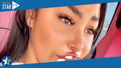 « En mode soudure » : Booba dévoile des clichés de la cicatrice nasale catastrophique de Maeva Ghenn