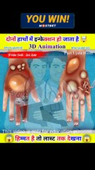 लड़के के दोनों हाथों में इन्फेक्शन हो जाता है  wait for end
